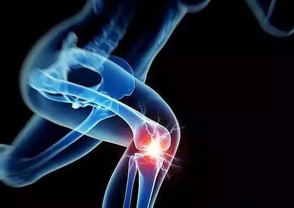 膝关节问题